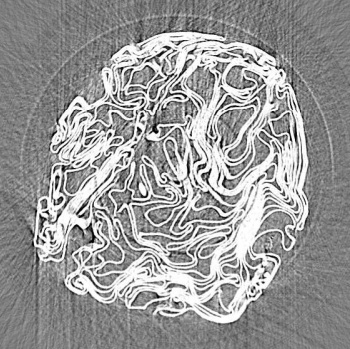 X-ray tomograph of a compressed aluminum foil ball