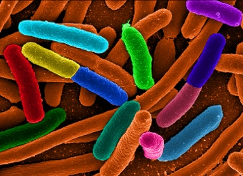 False color image of E. coli bacteria
