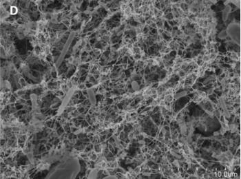 Scanning electron micrograph of coffee machine bacteria