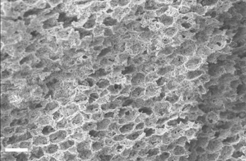 Scanning electron micrograph of the PRDC coating